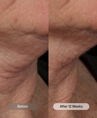 Nectifirm® Advanced 1.7 oz